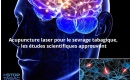 Acupuncture laser pour le sevrage tabagique, les études scientifiques approuvent