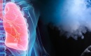 La cigarette électronique… une bombe à retardement pour les poumons !